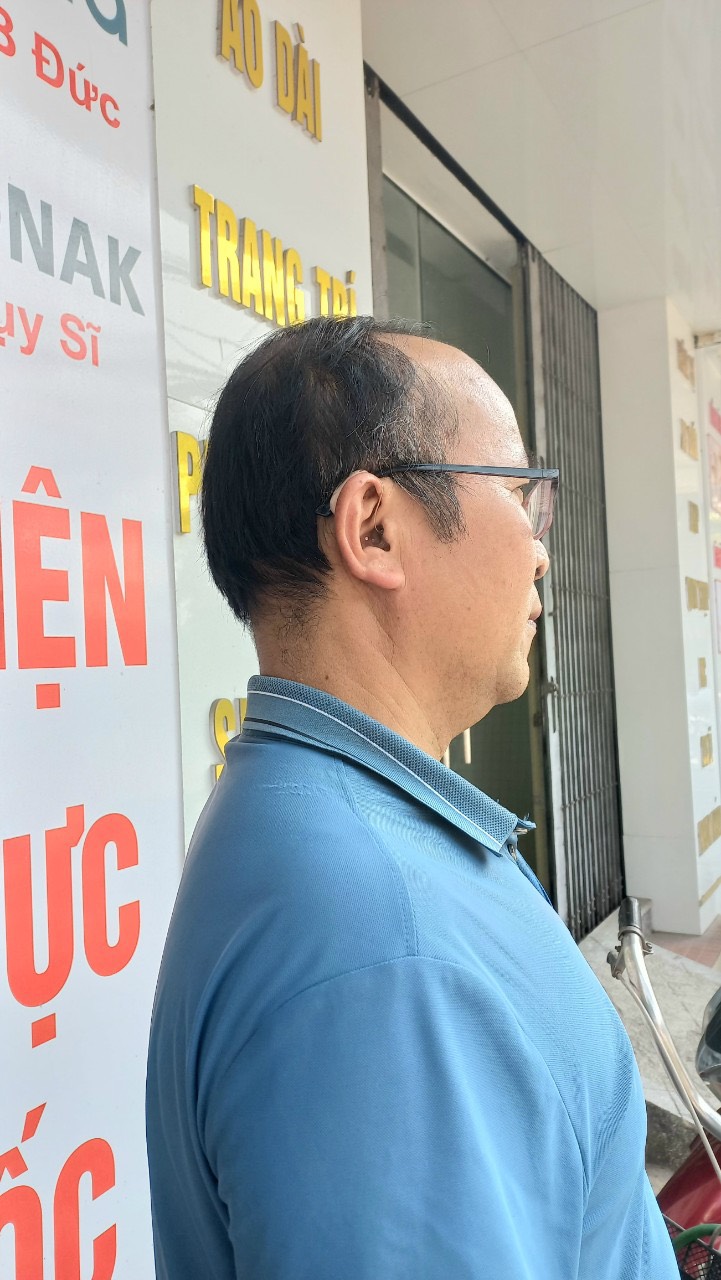 Máy Trợ Thính  Thông Minh