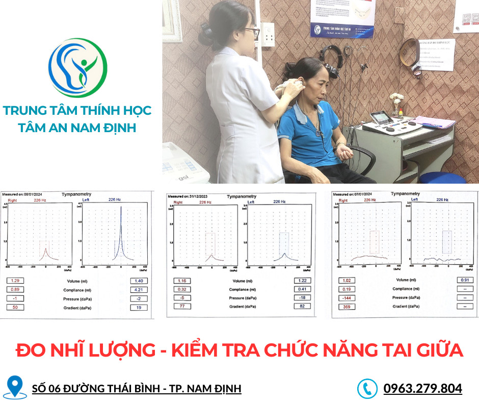 Nhĩ lượng: Phương pháp thăm dò chức năng tai giữa
