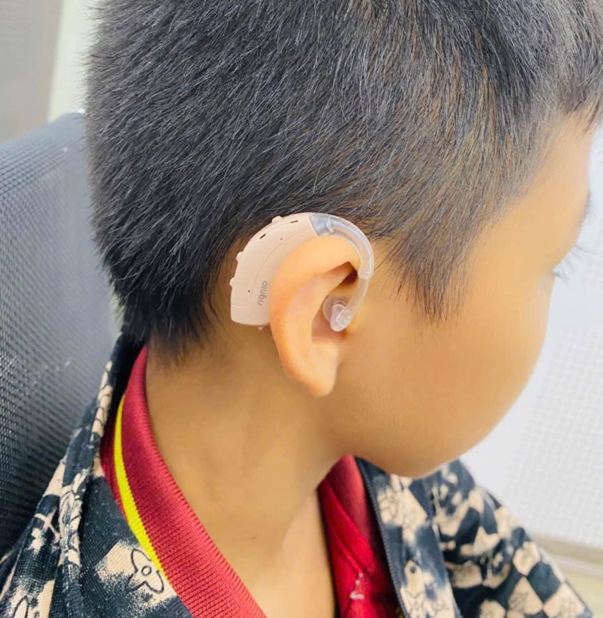 Nghe kém ảnh hưởng như thế nào đến sự phát triển của trẻ em?