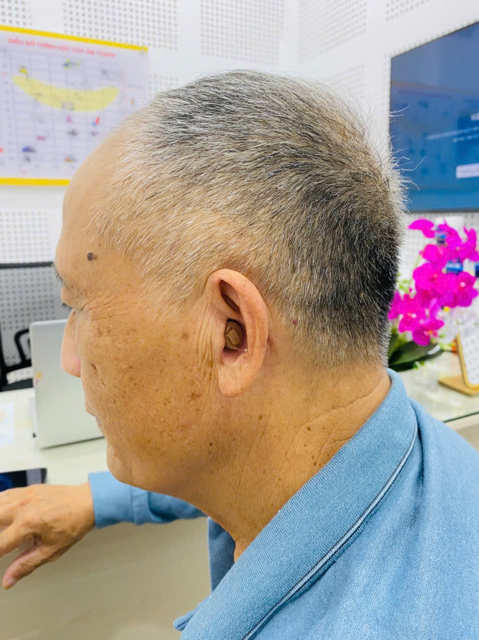 Máy trợ thính làm theo khuôn tai sẽ trông như thế nào?