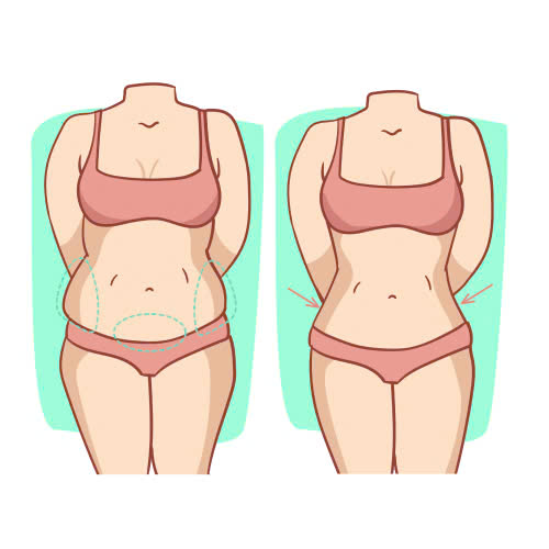 Hút mỡ bị lồi lõm có chỉnh sửa được không?