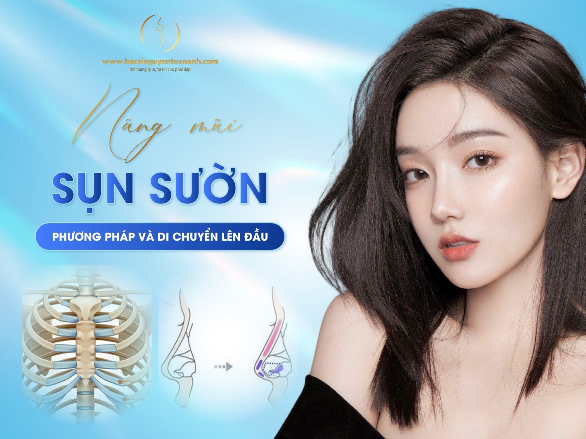 Nâng mũi cấu trúc sụn sườn