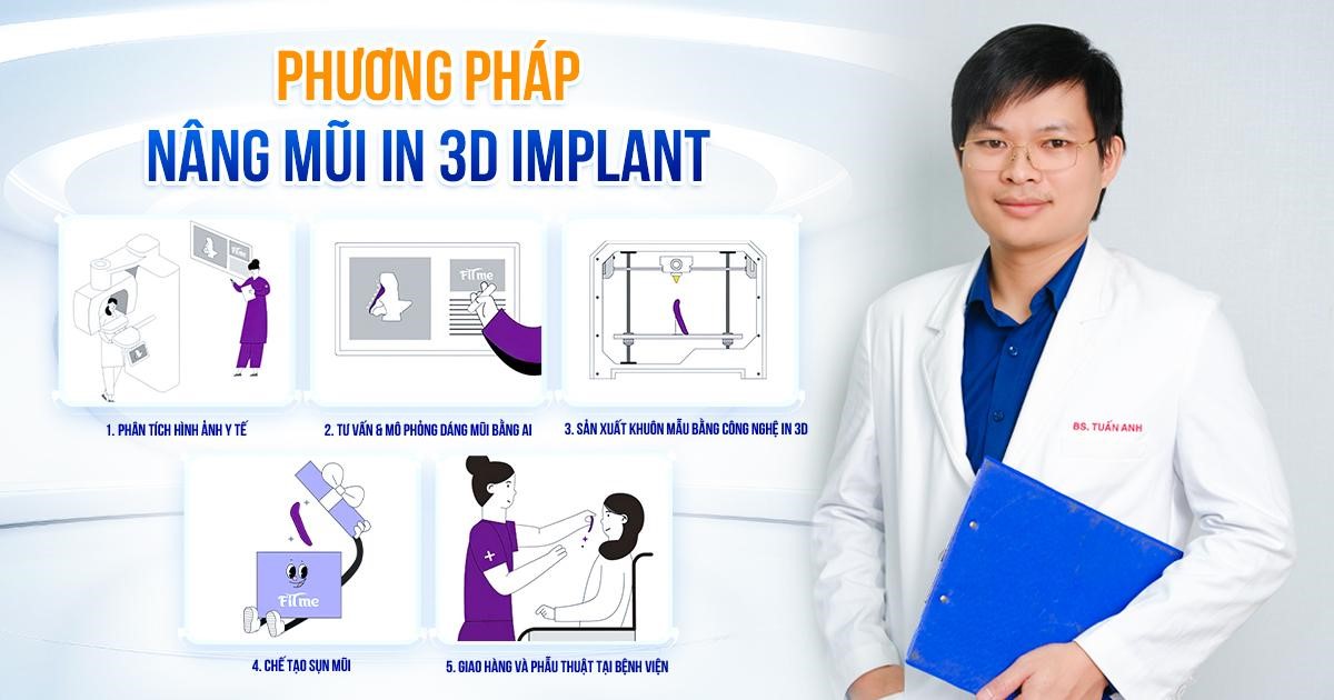 Giải pháp tạo dáng mũi chuẩn cá nhân hóa