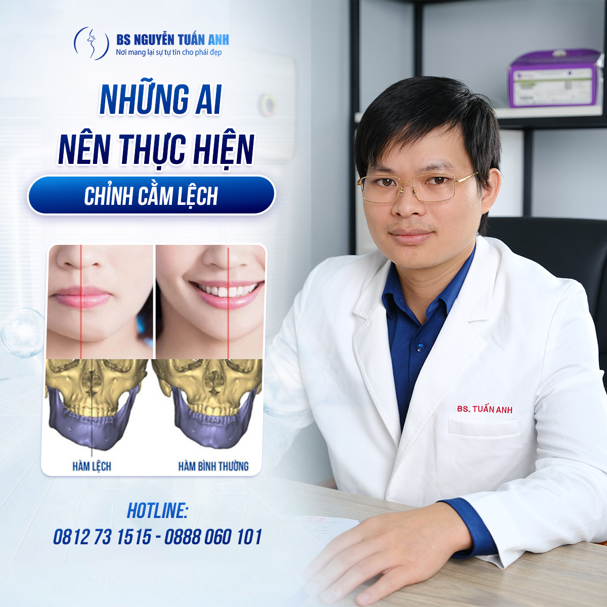 Chỉnh cằm lệch và góc nhìn trong nhân tướng