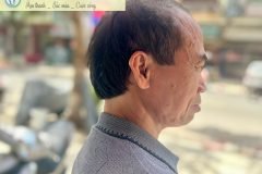 Lựa chọn máy trợ thính cho người cao tuổi tại Hưng Yên