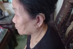 Dịch vụ lắp đặt máy trợ thính tận nhà tại trợ thính tâm an Hưng Yên