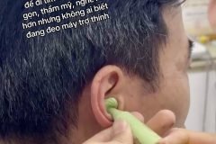 10 năm chịu đựng nghe kém để đi tìm một giải pháp đủ nhỏ gọn, đủ thẩm mỹ, đủ kín