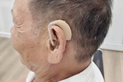 Bác tưởng máy hỏng… Nhưng thực ra đôi tai đã thay đổi sau 6 năm
