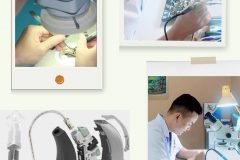 Chế độ hậu mãi dành cho khách hàng lắp đặt máy trợ thính tại trợ thính Tâm An