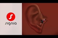 Máy trợ thính Signia Fast P mang công nghệ Đức đến gần hơn với bạn