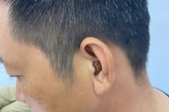 Máy trợ thính trong tai bí mật dành cho người trẻ tuổi