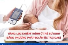 Sàng lọc khiếm thính ở trẻ sơ sinh bằng đo âm ốc tai (OAE)