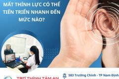 Mất thính lực có thể tiến triển nhanh đến mức nào?