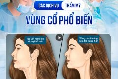 Các dịch vụ liên quan đến thẩm mỹ vùng cổ