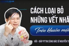 Nếp nhăn trên khuôn mặt