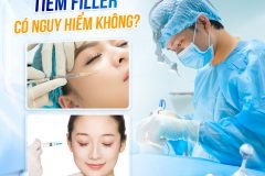 Tiêm Filler là gì và vì sao lại được ưa chuộng?