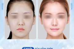 Cằm tròn đầy: Biểu tượng cuộc sống giàu sang viên mãn
