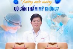 Tướng Môi Mỏng