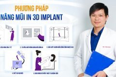 Giải pháp tạo dáng mũi chuẩn cá nhân hóa