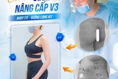 Combo giảm mỡ nâng cấp vòng 3