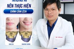 Chỉnh cằm lệch và góc nhìn trong nhân tướng