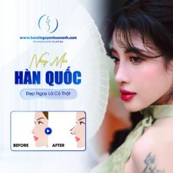 Nâng mũi Hàn Quốc đẹp ngay là có thật!!!