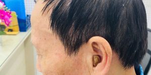 Máy trợ thính siêu nhỏ trong tai CIC