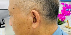 Máy trợ thính làm theo khuôn tai sẽ trông như thế nào?