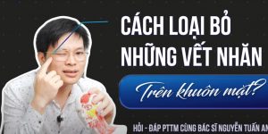 Nếp nhăn trên khuôn mặt