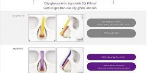 Xu hướng tạo dáng mũi cá nhân hóa hiện nay