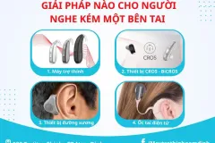 Giải pháp nghe cho người mất thính lực tại Ninh Bình