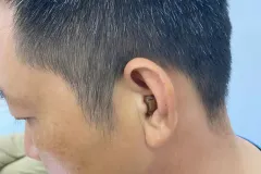 Máy trợ thính trong tai bí mật tại Hưng Yên