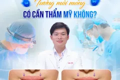 Tướng Môi Mỏng - Tư Vấn Thẩm Mỹ Tại TP.HCM