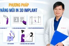 Giải pháp nâng mũi 3D tại TP.HCM