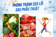 Khắc phục sẹo lồi sau cắt mí tại TP.HCM
