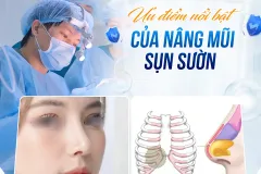 Nâng mũi sụn sườn tại Thành phố Hồ Chí Minh